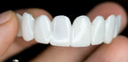 Set of dental veneers held between fingers against a dark background