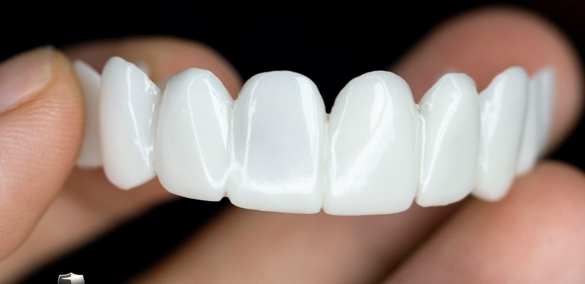 Set of dental veneers held between fingers against a dark background