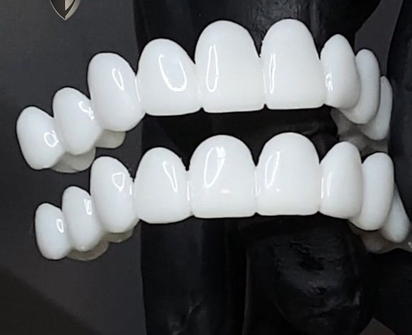 White dental aligners covering a person's mouth against a dark background