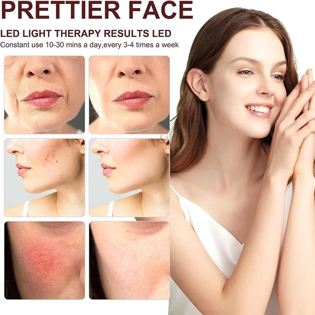 LED light therapy results for skin improvement with a woman showing clear skin.