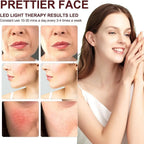 LED light therapy results for skin improvement with a woman showing clear skin.